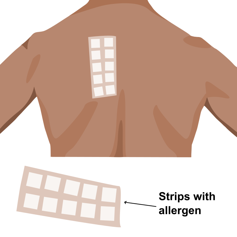 Illustration showing a patch applied on a person's back