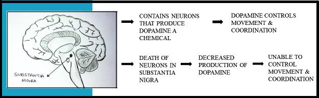 Diagram explaining subtantia nigra, dopamine production and effect on movement 